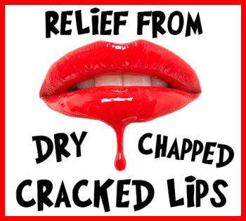Saxonburg dentist, Dr. Sepich at Saxonburg Dental Care, tells you how to relieve your dry, chapped, and cracked lips!