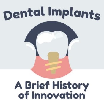 Saxonburg dentist, Dr. Roger M. Sepich at Saxonburg Dental Care, discusses dental implants and shares some information about their history.