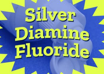 Saxonburg dentist, Dr. Roger Sepich, of Saxonburg Dental Care discusses silver diamine fluoride as a cavity fighter that helps patients—especially pediatric patients—avoid the dental drill.