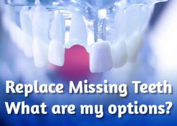 Replace missing teeth: what are my options?
